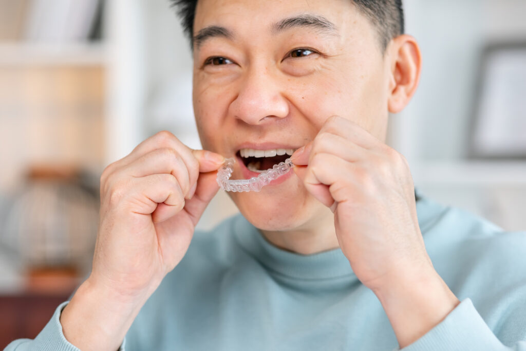clear aligner adult